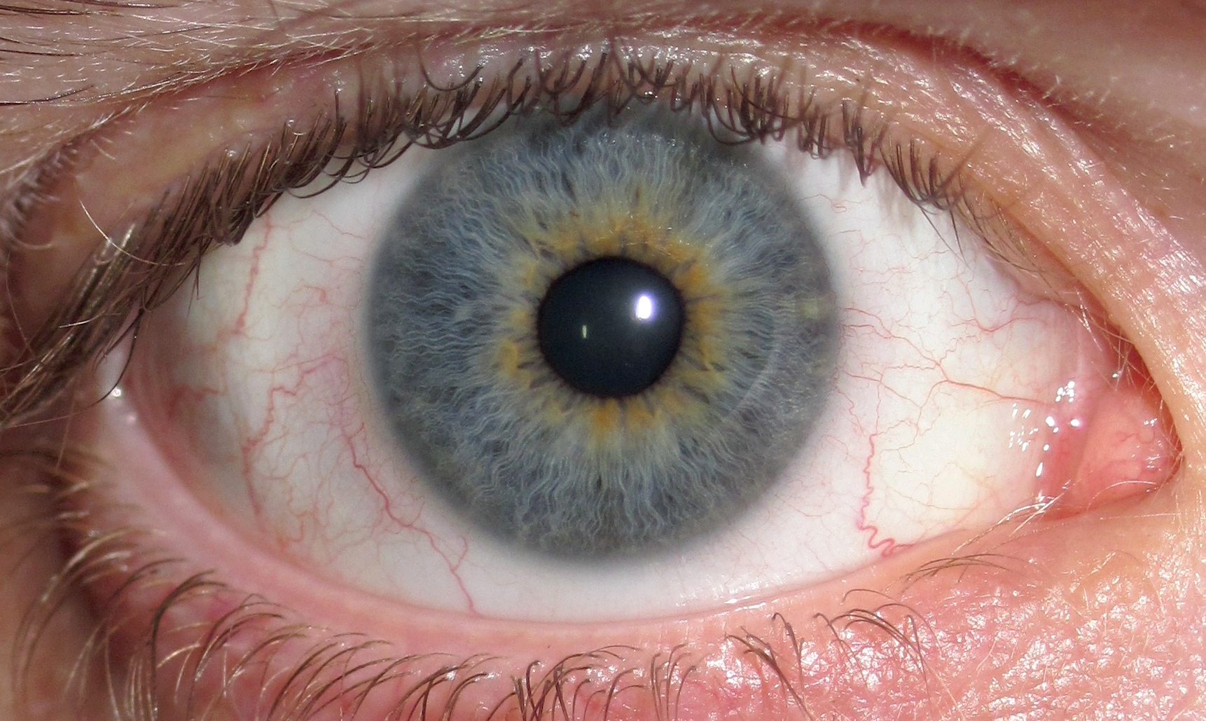 Eye_Central_Heterochromia_crop_and_light