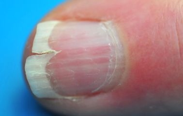 sig-4829270.Vertical-ridging-nails.jpg